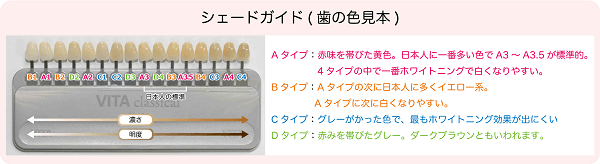 シェードとホワイトニング期間の目安