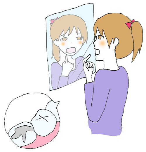 銀歯に困る女性