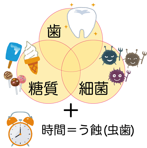虫歯の4大原因