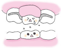 上下が磨り減ってしまうと入れ歯が合わなくなる